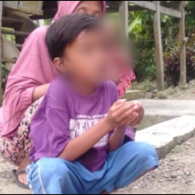 Butuh Biaya Bocah Dengan Anus Buatan Asal Banten Malah Diperhatikan Jokowi