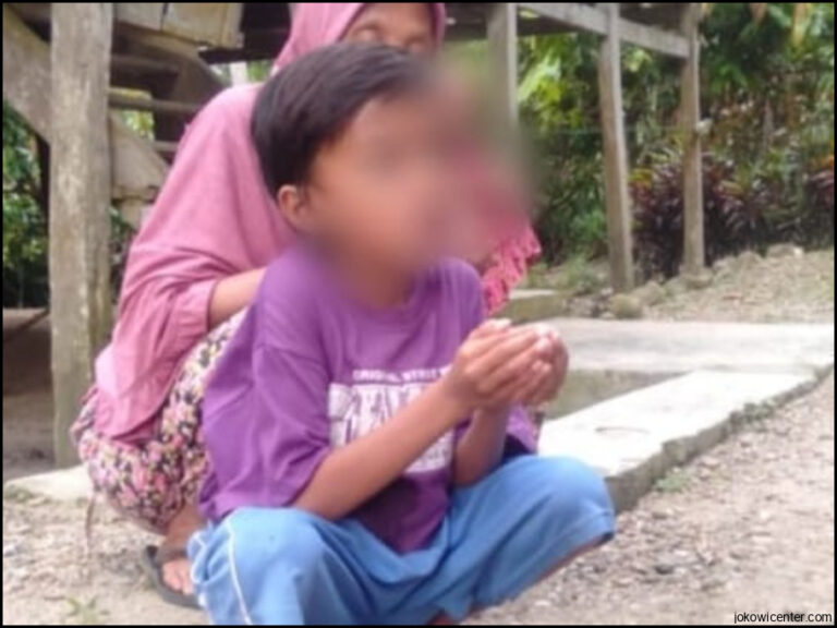 Butuh Biaya Bocah Dengan Anus Buatan Asal Banten Malah Diperhatikan Jokowi